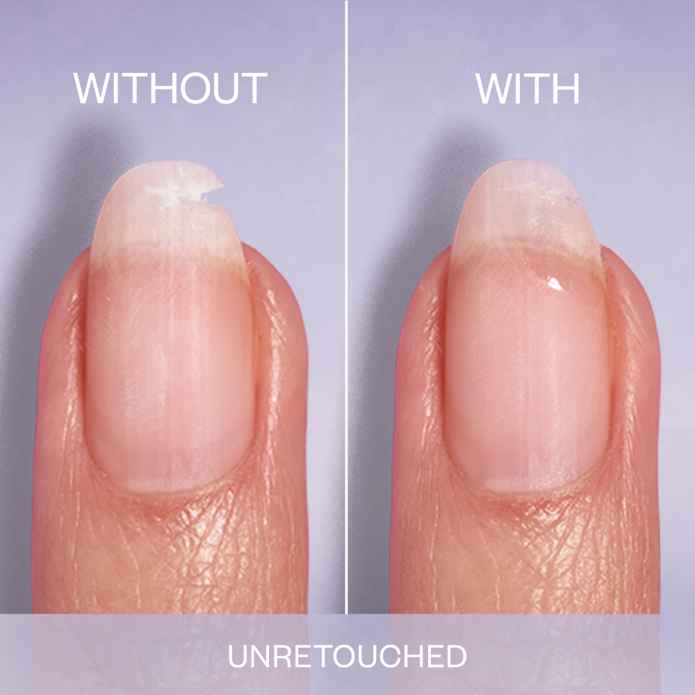 Essie - Break Fix Liquid Nail Patch