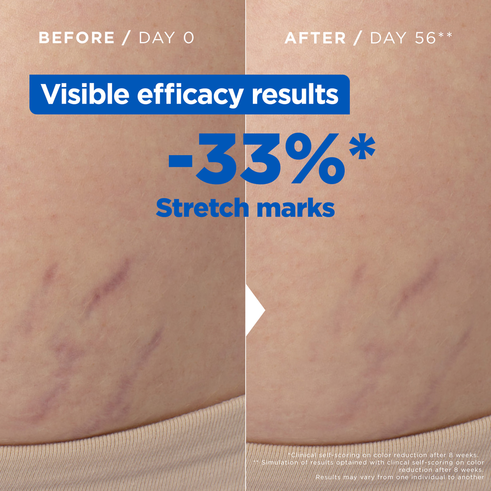 Mixa - Stretch Mark Oil