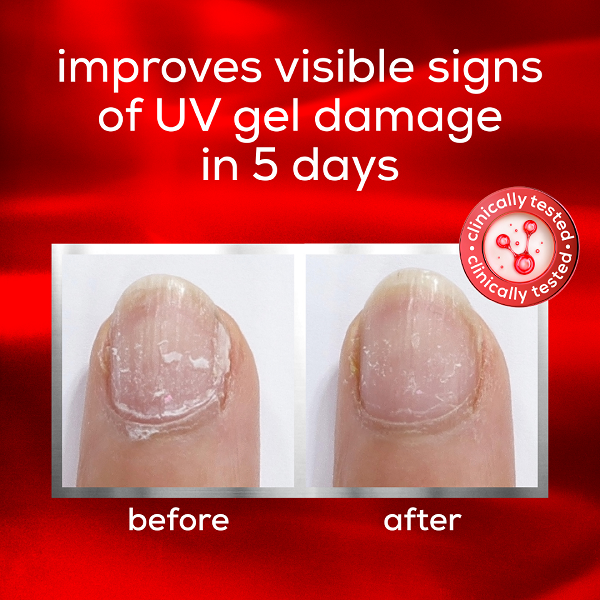 Essie - To The Rescue UV Gel Damage