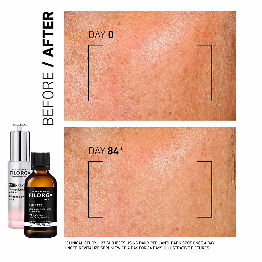 Filorga - Daily Peel Anti Dark Spot Solution