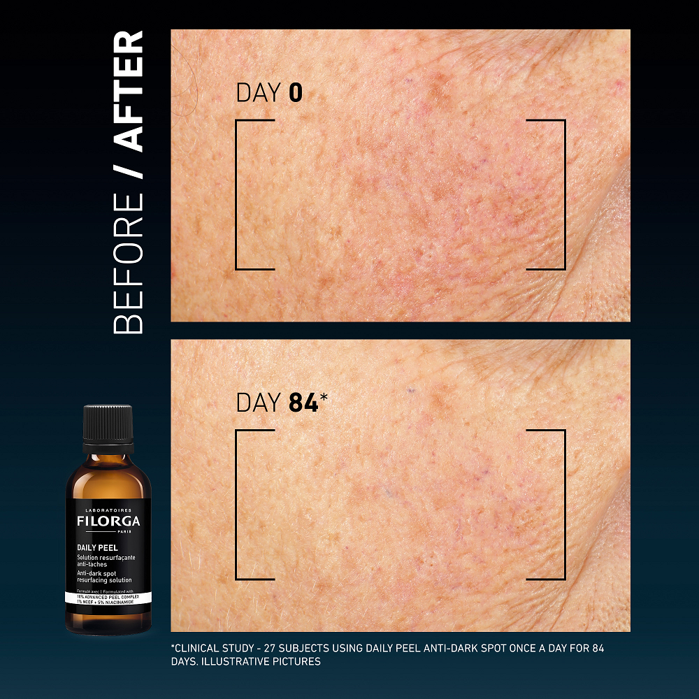 Filorga - Daily Peel Anti Dark Spot Solution