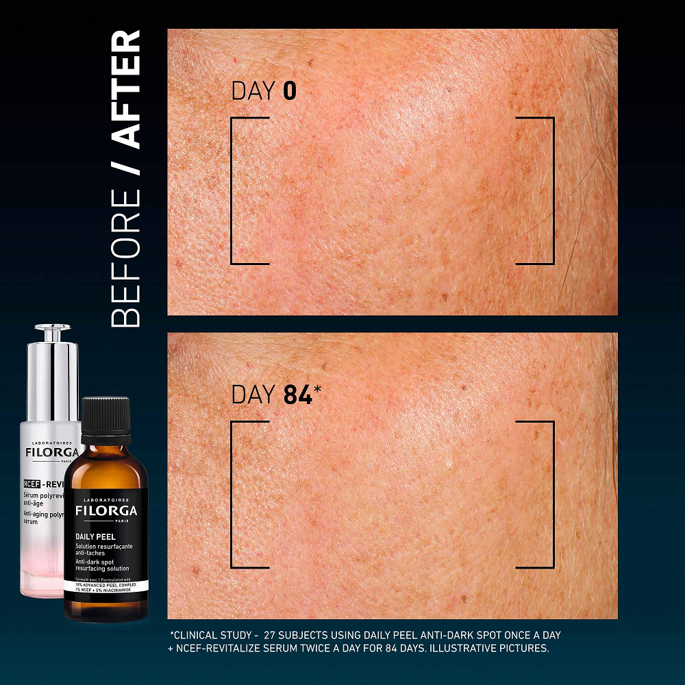 Filorga - Daily Peel Anti Dark Spot Solution