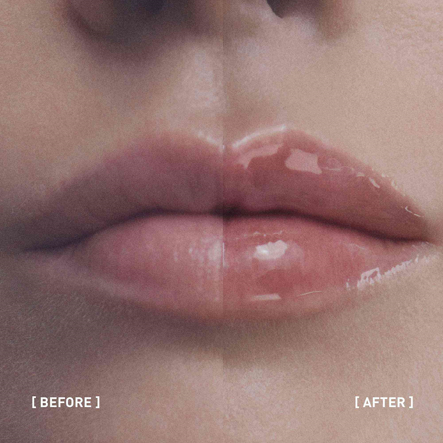 Filorga - Hyalu Filler Lips