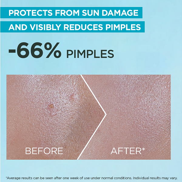 Garnier - Super UV Acne Prone Skin Sunscreen Serum SPF50+