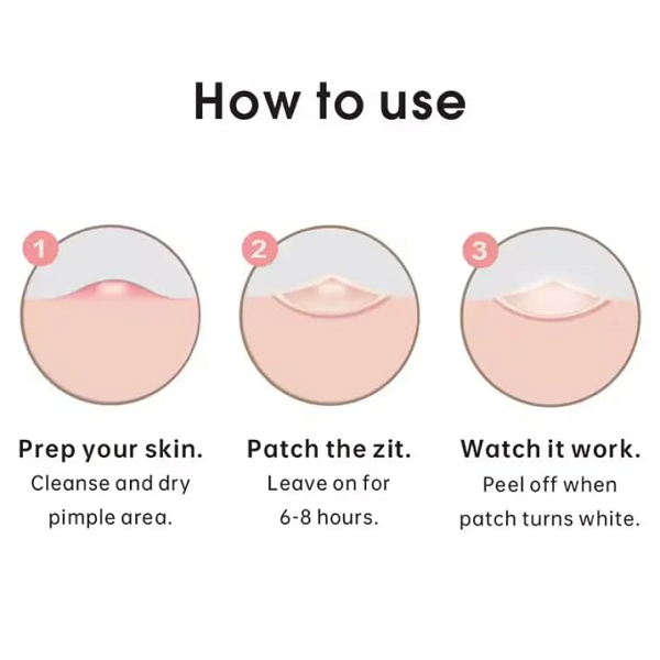 The Original - Acne Patch