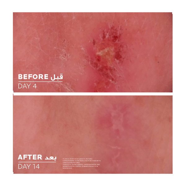 La Roche Posay - Cicaplast Baume B5+ - ORAS OFFICIAL