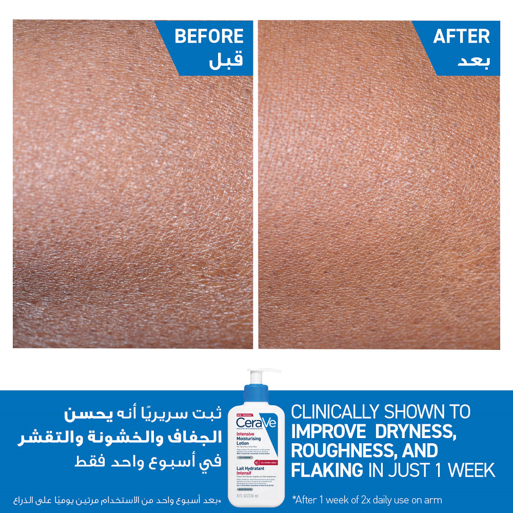 Cerave - Intensive Moisturising Lotion