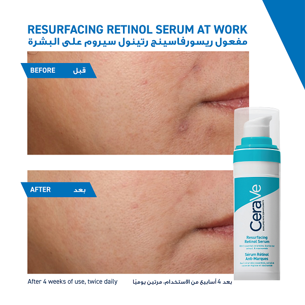 Cerave - Resurfacing Retinol Serum