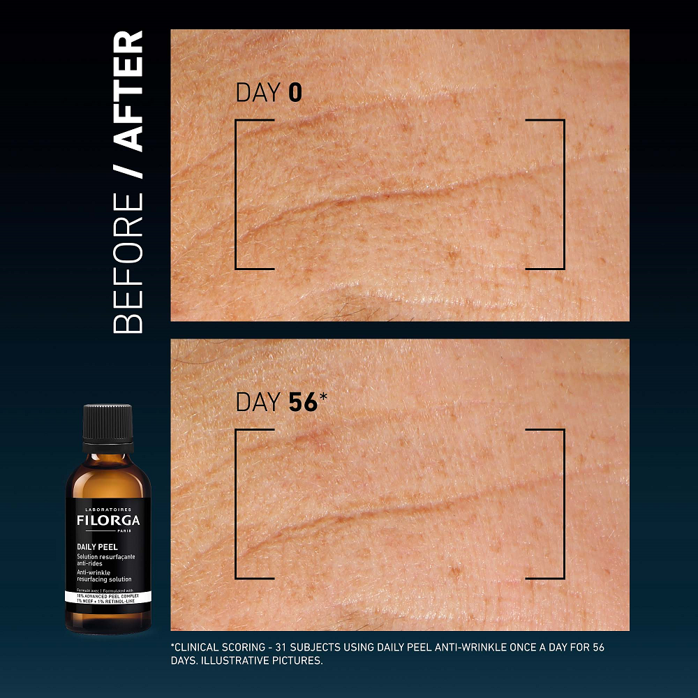 Filorga - Daily Peel Anti Wrinkle Resurfacing Solution