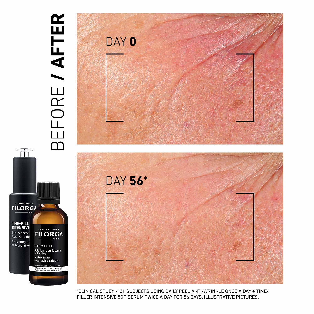 Filorga - Daily Peel Anti Wrinkle Resurfacing Solution