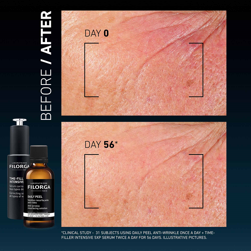 Filorga - Daily Peel Anti Wrinkle Resurfacing Solution