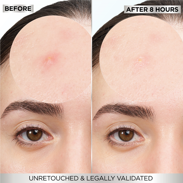 Garnier - Pimple Patch Invisible