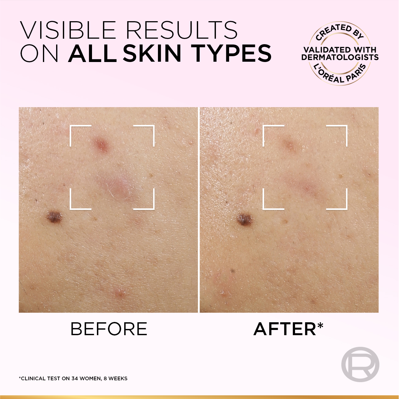 L'Oreal - Glycolic Bright Exfoliant Peel