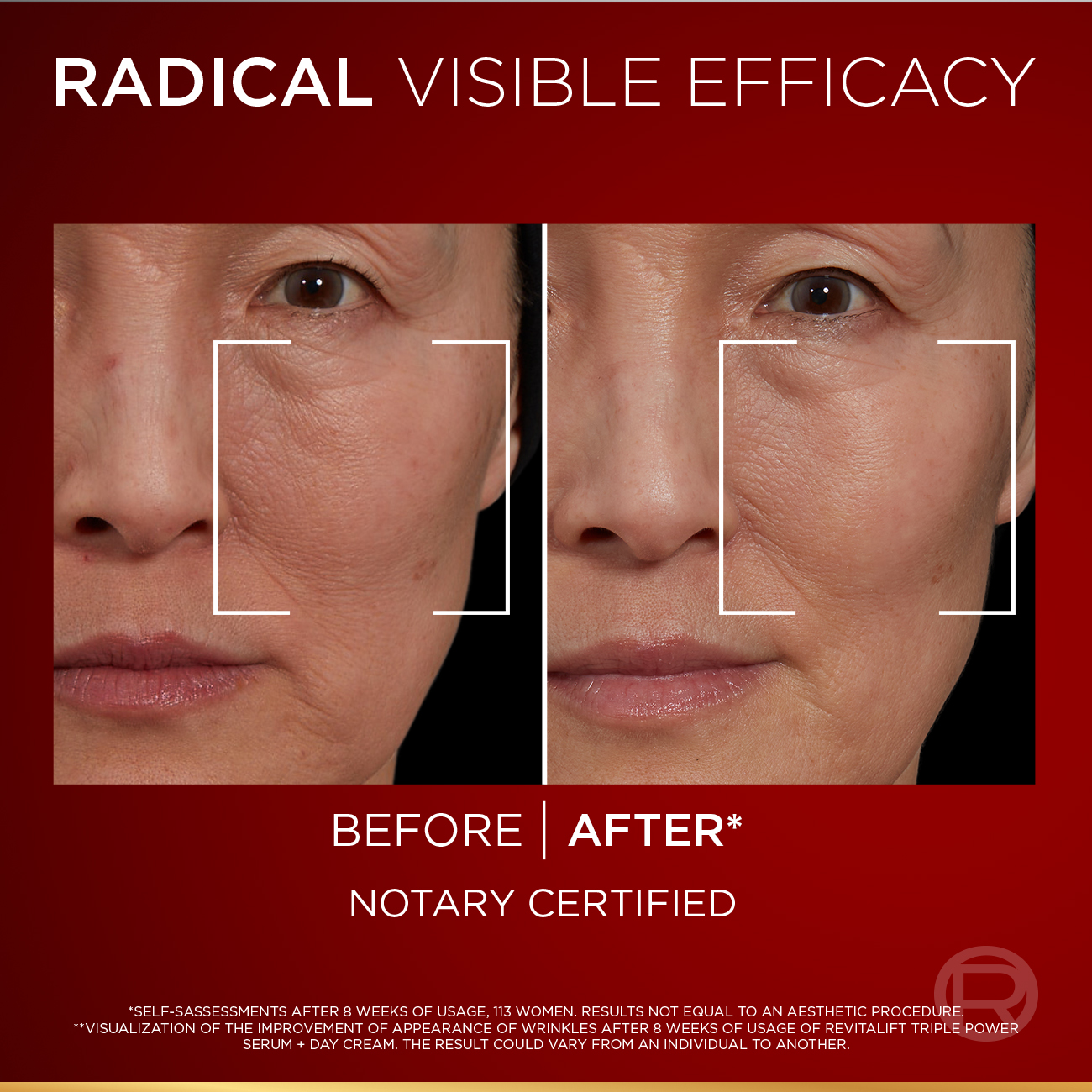 L'Oreal - Revitalift Triple Power Serum