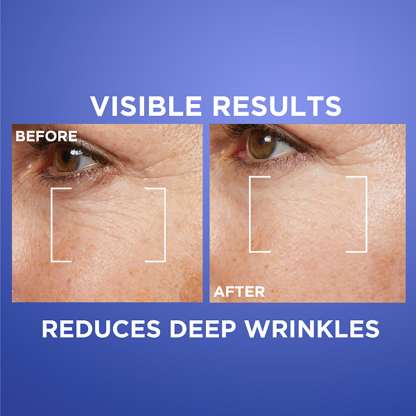 L'Oreal Skin Expert - Revitalift Laser Pure Retinol Night Serum