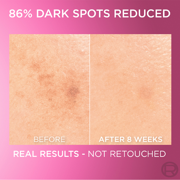 L'oreal Skin Expert - Glycolic Bright Brightening Serum