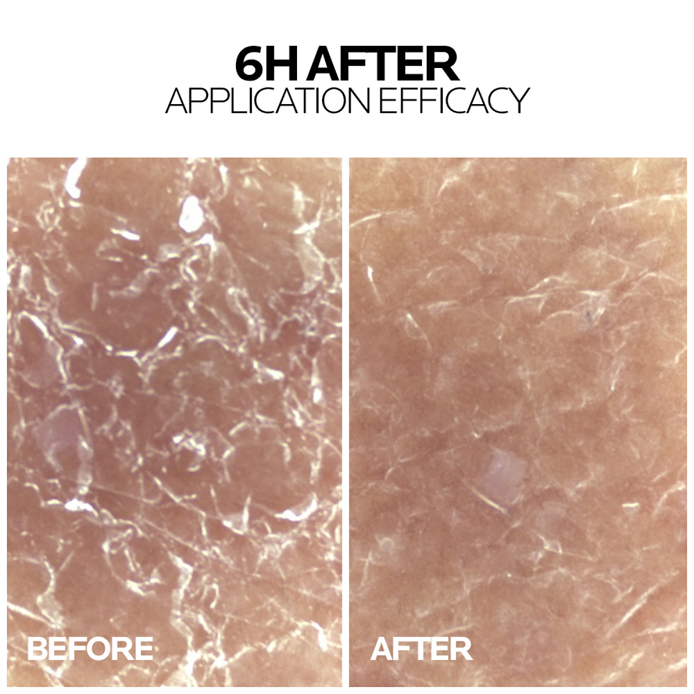 La Roche Posay - Lipikar AP+ Max Triple Action Balm 72H