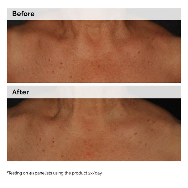 The Ordinary - Body Care Niacinamide 5% Face & Body Emulsion