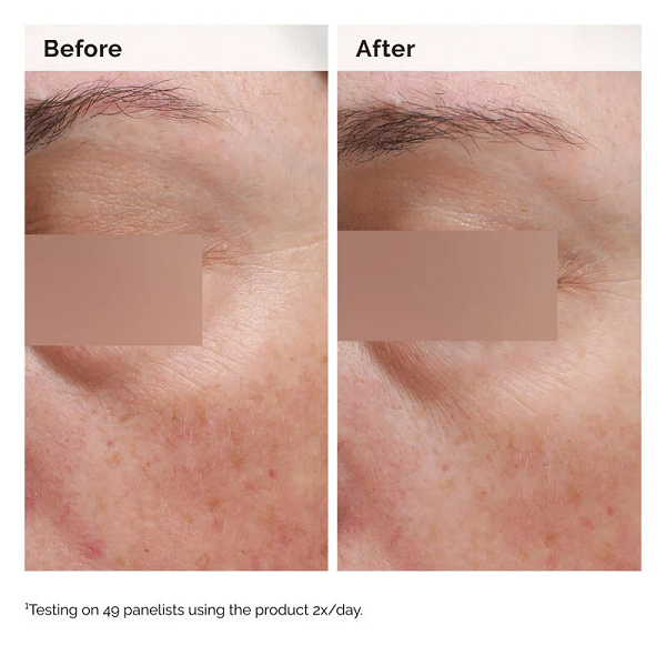 The Ordinary - Body Care Niacinamide 5% Face & Body Emulsion